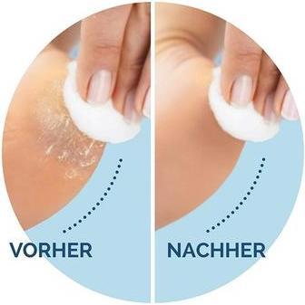 Produktbild Scholl Hornhautentferner Ersatzrollen (2 x)