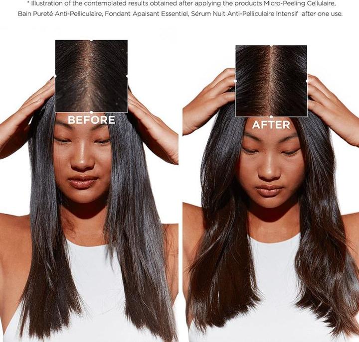 Immagine prodotto Kérastase Set di cura purificante Symbiosis 7 (Set per la cura dei capelli)