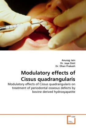 Actual product image Modulatory effects of Cissus quadrangularis (German, Dhan Prakash, Anurag Jain, Jaya Dixti, 2010)