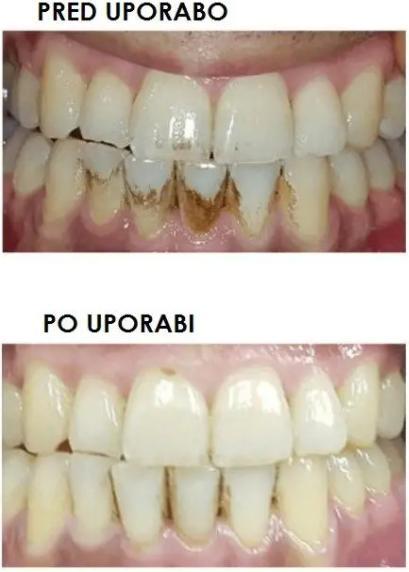 Produktbild Silk'n ToothWave (Schallzahnbürste)