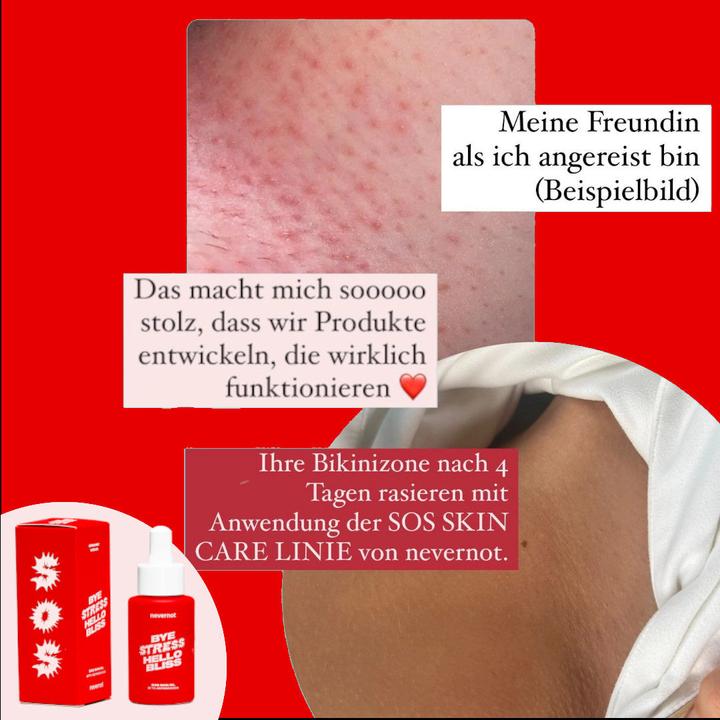 Image du produit NeverNot - Huile SOS pour la peau (30 ml, Huile de toilette intime)