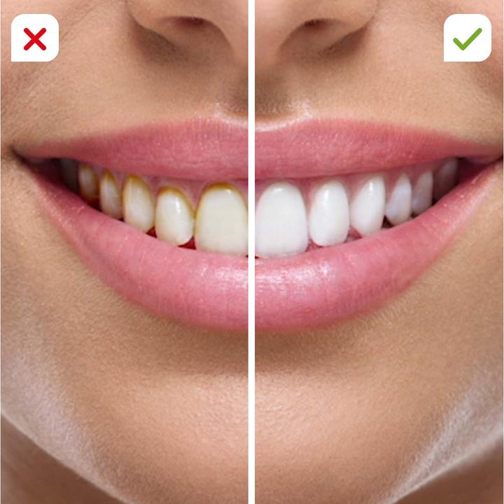 Image du produit MediaShop CorpCare Miracle Smile