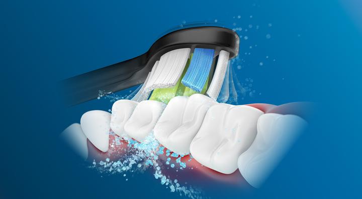 Image du produit Philips Sonicare W2 Blanc optimal (4 x)