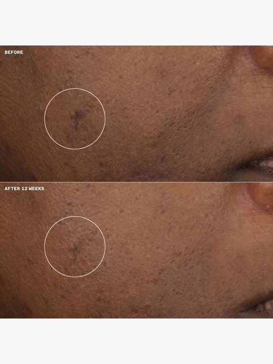 Produktbild Clinique Even Better (50 ml)