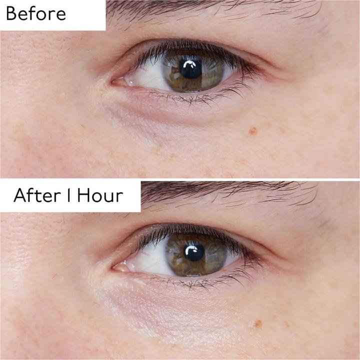 Produktbild By Terry Hyaluronic Global Eye Serum (Serum, 15 ml)