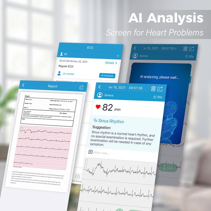Immagine prodotto ViatomTech BP2 Connect Wi-Fi upper arm bp monitor with ECG (Sfigmomanometro per braccio)