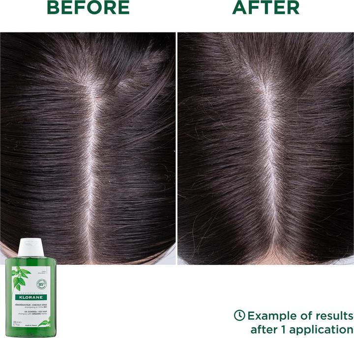 Image du produit Klorane Contrôle de l'huile d'ortie (400 ml, Shampoing liquide)