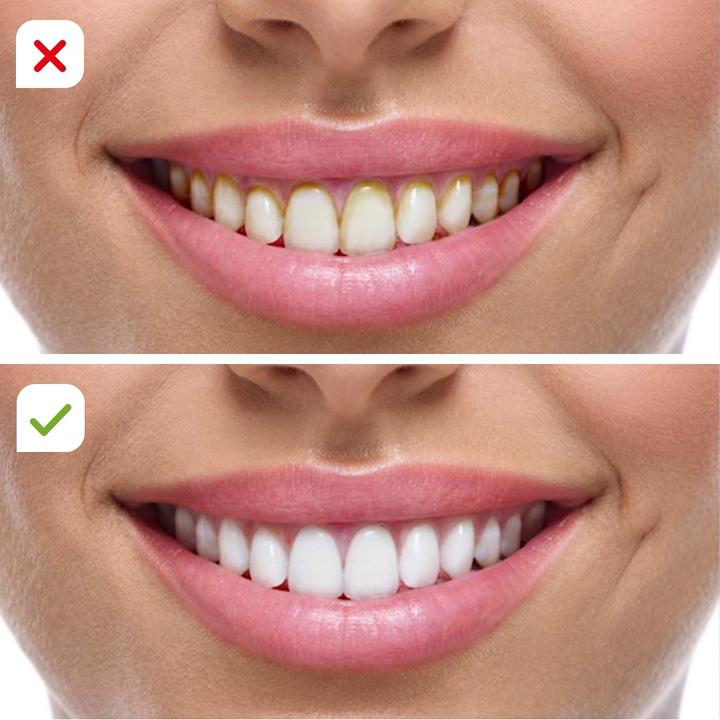 Produktbild MediaShop CorpCare Miracle Smile