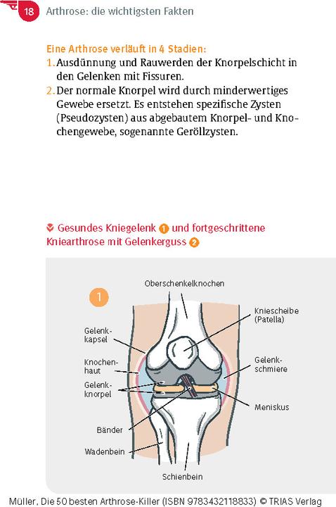 Actual product image Die 50 besten Arthrose-Killer (German, Sven-David Miller, 2024)