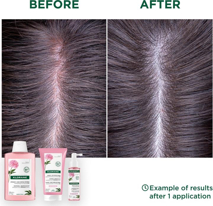 Actual product image Klorane Soothing shampoo with organic peony (200 ml, Liquid shampoo)