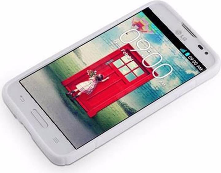 Actual product image Cadorabo TPU X-Line Cover (LG L70)