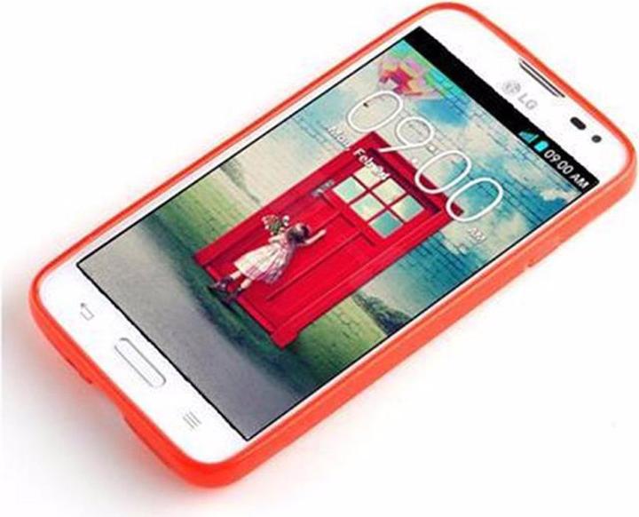 Productafbeelding Cadorabo TPU X-Line Cover (LG L70)