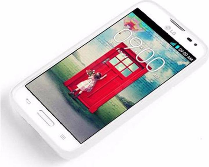 Image du produit Cadorabo TPU X-Line Cover (LG L70)