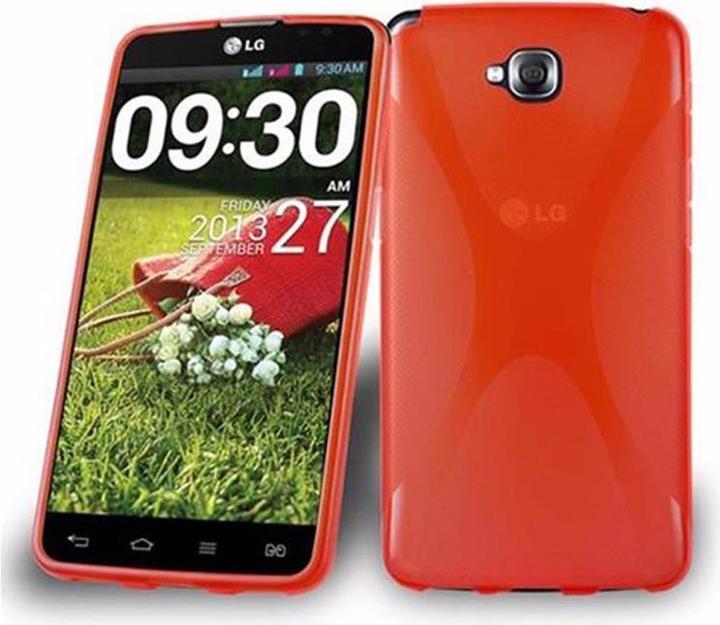 Actual product image Cadorabo TPU X-Line Cover (LG G Pad Pro Lite)
