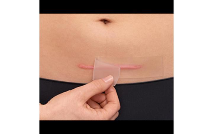 Actual product image Hansaplast Narben Reduktion Pflaster XL (21 x)