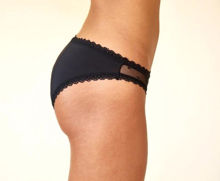Actual product image Sisters Republic Bikini Sidonie (M)