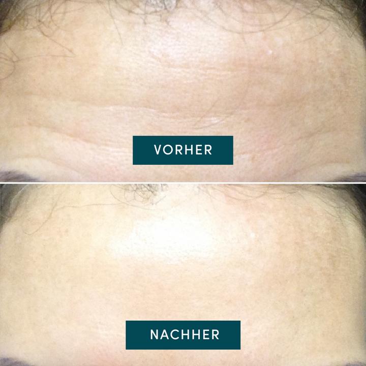 Image du produit Apricot wiederverwendbares Stirn Pad Aloe Vera "aloe you ready?"