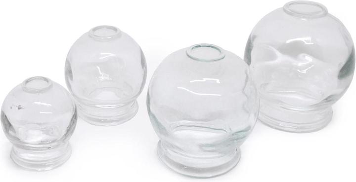 Schröpfglas