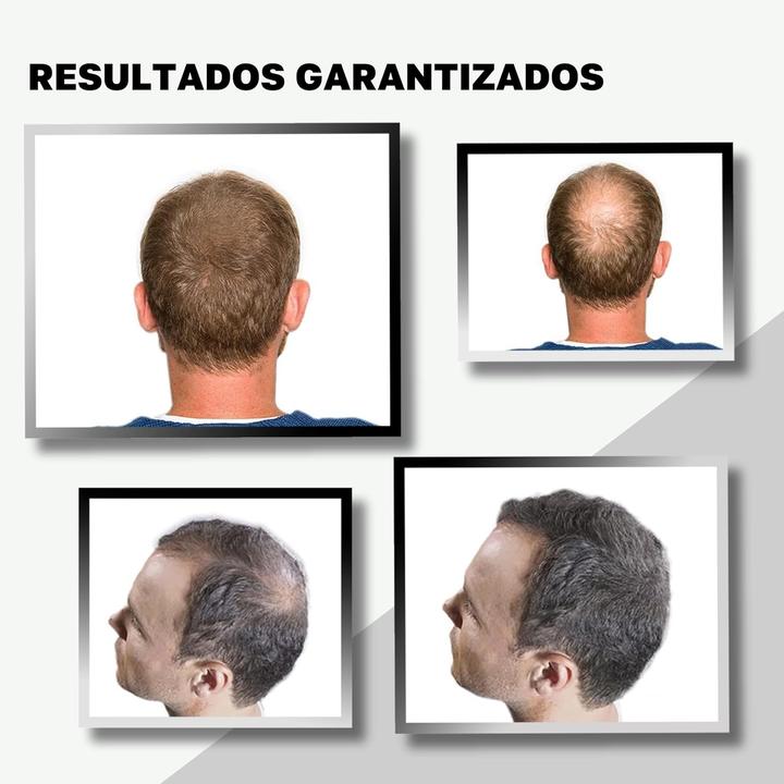 Image du produit Vidal Schütthaar Ansatzpuder zur Haarverdichtung (Brun foncé)