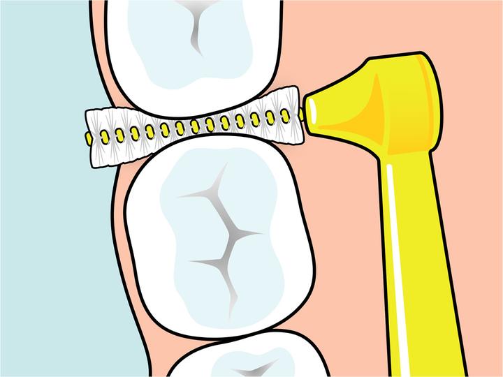 Produktbild TePe Interdentalbürsten Angle ISO 0 (6 x, 0.40 mm)