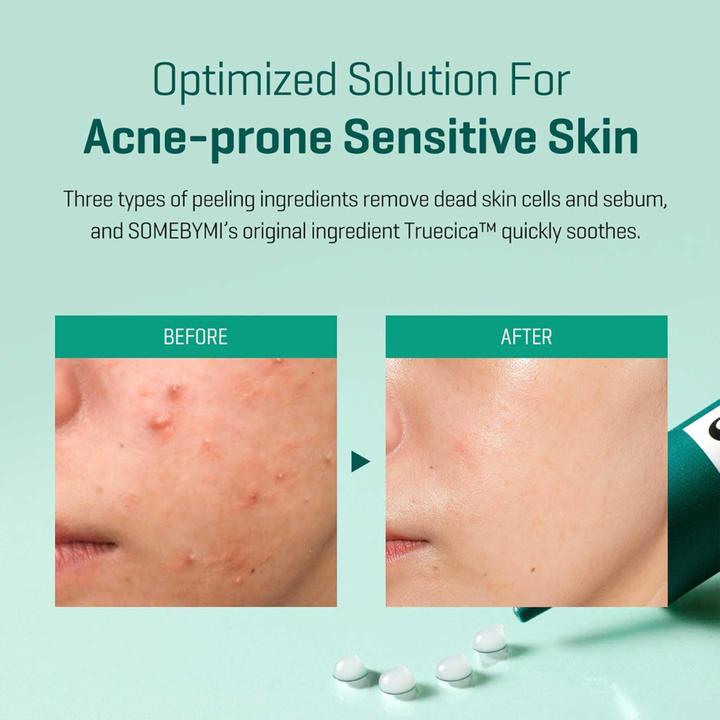 Produktbild Some By Mi AHA.BHA.PHA 4Days Super Miracle Spot All Kill Cream (30 ml, 24h Creme)