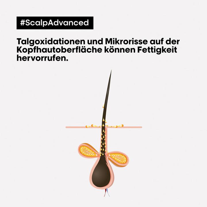 Image du produit L'Oréal Professionnel Scalp Advanced (250 ml)