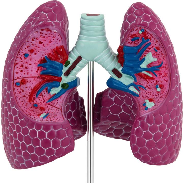 Produktbild Physa Lungenmodell 1:1 Organmodell menschliche Lunge anatomisches Modell Medizinmodell
