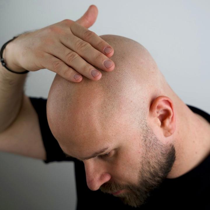 Produktbild Better be bold Bartöl und Glatzenöl - Bald Head & Beard Oil with Diamond Shine-Effect