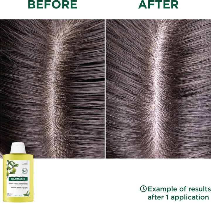 Actual product image Klorane Zedrat revitalising shampoo (200 ml, Liquid shampoo)