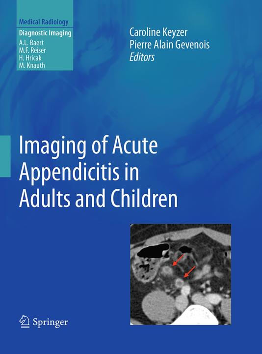 Produktbild Imaging of Acute Appendicitis in Adults and Children (Englisch, Pierre Alain Gevenois, Caroline Keyzer, 2016)