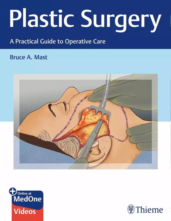 Image du produit Plastic Surgery: A Practical Guide to Operative Care (Anglais, Bruce A. Mast, 2021)