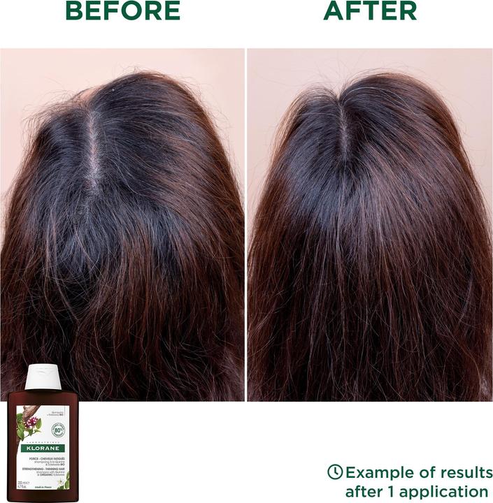 Produktbild Klorane Chinin Edelweiss Shampoo (100 ml, Flüssiges Shampoo)