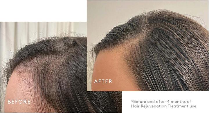 Actual product image Virtue Labs Flourish Hair Rejuvenation Treatment 1 month supply Set (Hair care set)