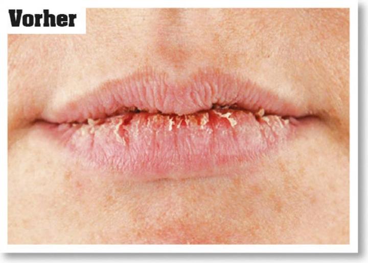 Produktbild O'Keeffe's Lip Repair Unparfümierter Lippenbalsalm (Pflegestift)