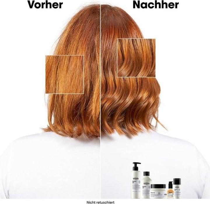 Actual product image L'Oréal Professionnel Serie Expert Metal DX (300 ml, Liquid shampoo)