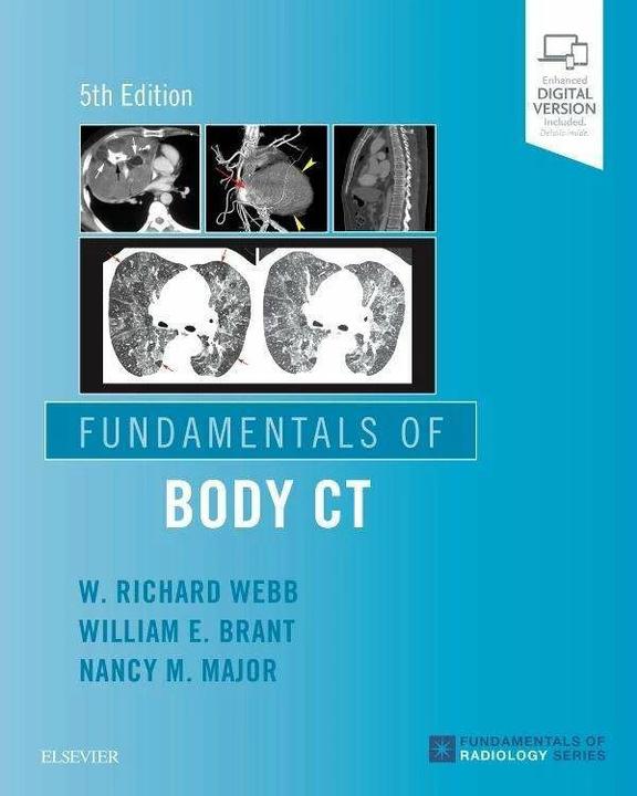 Actual product image Fundamentals of Body Ct (English, W. Richard Webb, Nancy M. Major, William E. Brant, 2019)