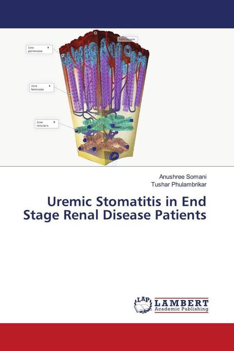 Immagine prodotto Uremic Stomatitis in End Stage Renal Disease Patients (Tedesco, TUSHAR PHULAMBRIKAR, Anushree Somani, 2023)