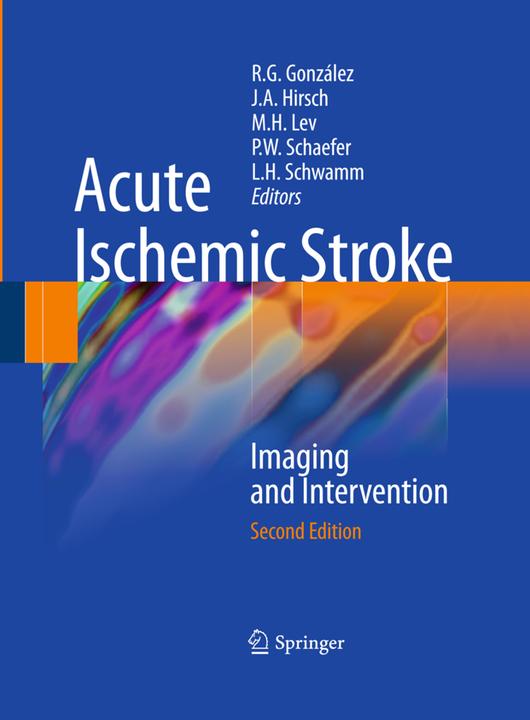 Actual product image Acute Ischemic Stroke (English, Pamela W. Schaefer, R. Gilberto González, Michael H. Lev, Lee H. Sponge, Joshua A. Hirsch, 2014)