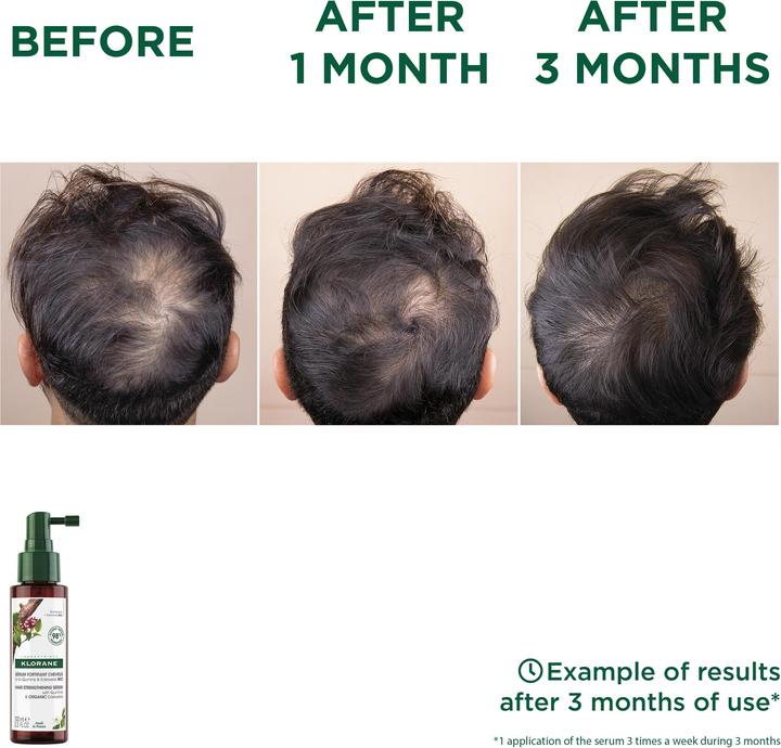 Produktbild Klorane Serum gegen Haarausfall (100 ml)