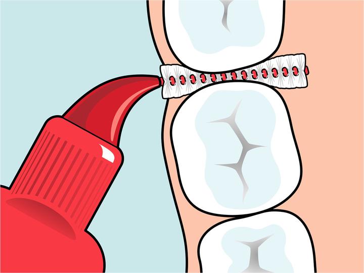 Produktbild TePe Interdentalbürsten Original ISO 2 (20 x, 0.50 mm)