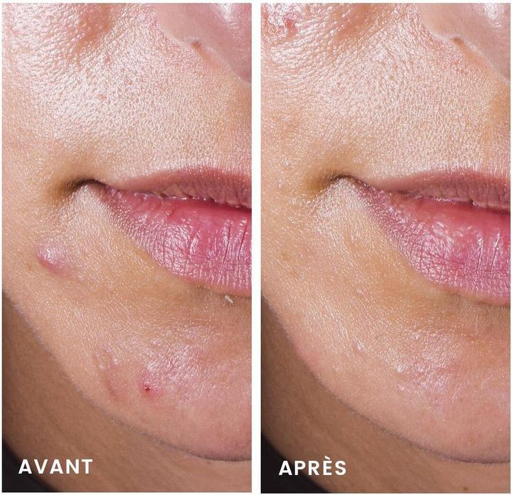 Produktbild Avène Cleanance Comedomed (30 ml, 24h Creme)