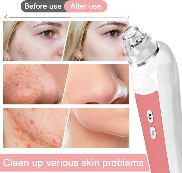 Produktbild Prabensei Blackhead Remover