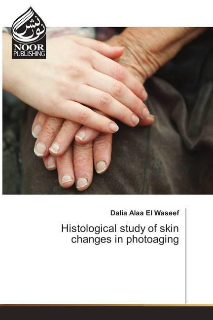 Produktbild Histological study of skin changes in photoaging (Dalia Alaa El Waseef, 2018)
