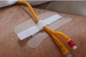 Image du produit Secutape Kit de fixation en non-tissé 10 pcs