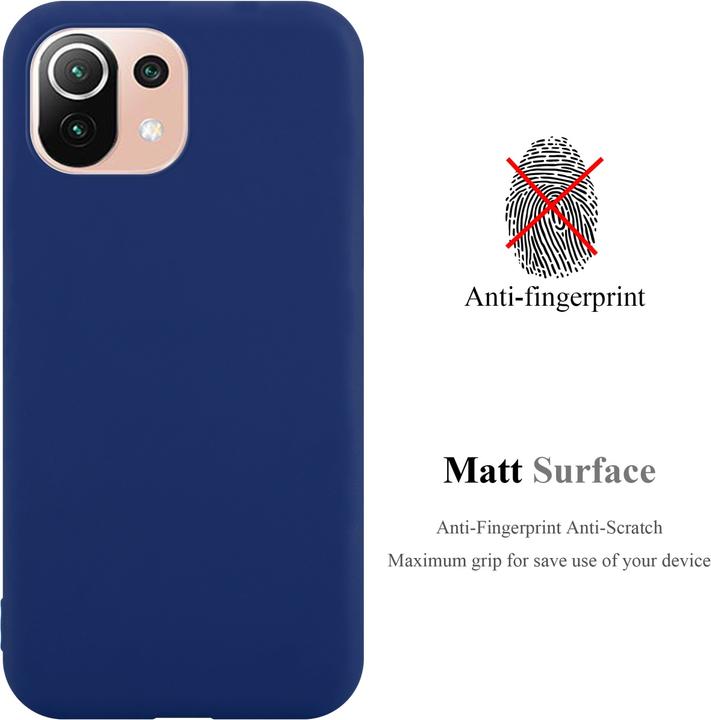 Actual product image Cadorabo TPU Candy shell (Xiaomi Mi 11 Lite, Xiaomi Mi 11 Lite 5G)