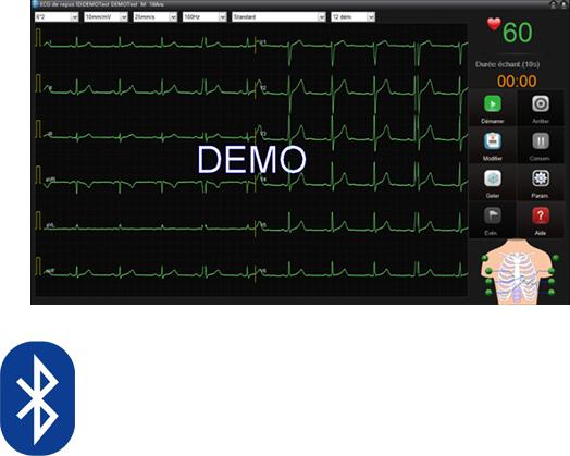 Produktbild Edan Ruhe-EKG SE-1515 DX12 (Bluetooth)