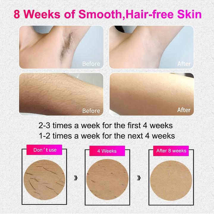 Actual product image Veme Laser Hair Removal Device
