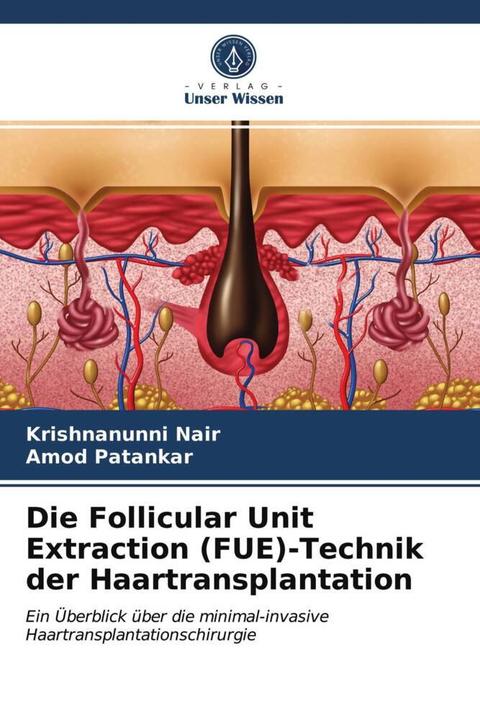 Immagine prodotto Die Follicular Unit Extraction (FUE)-Technik der Haartransplantation (Tedesco, Amod Patankar, Krishnanunni Nair, 2021)