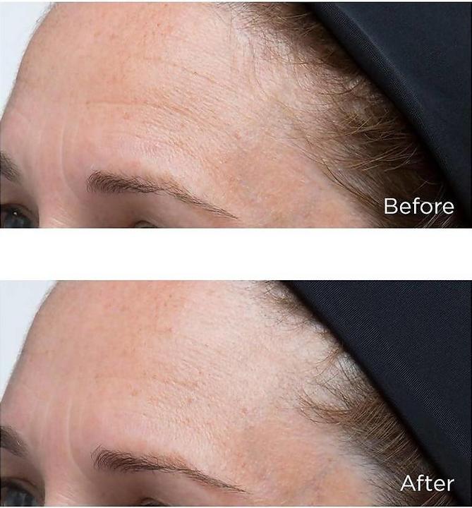 Image du produit Perricone MD High Potency Classics Hyaluronic Crème Hydratante Intensive pour le visage Gel Femme 30 ml (30 ml, Crème de jour, Gel visage)