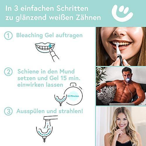 Produktbild UniqueSmile Teeth Whitening (Kit)